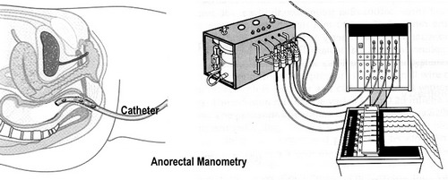 manometry